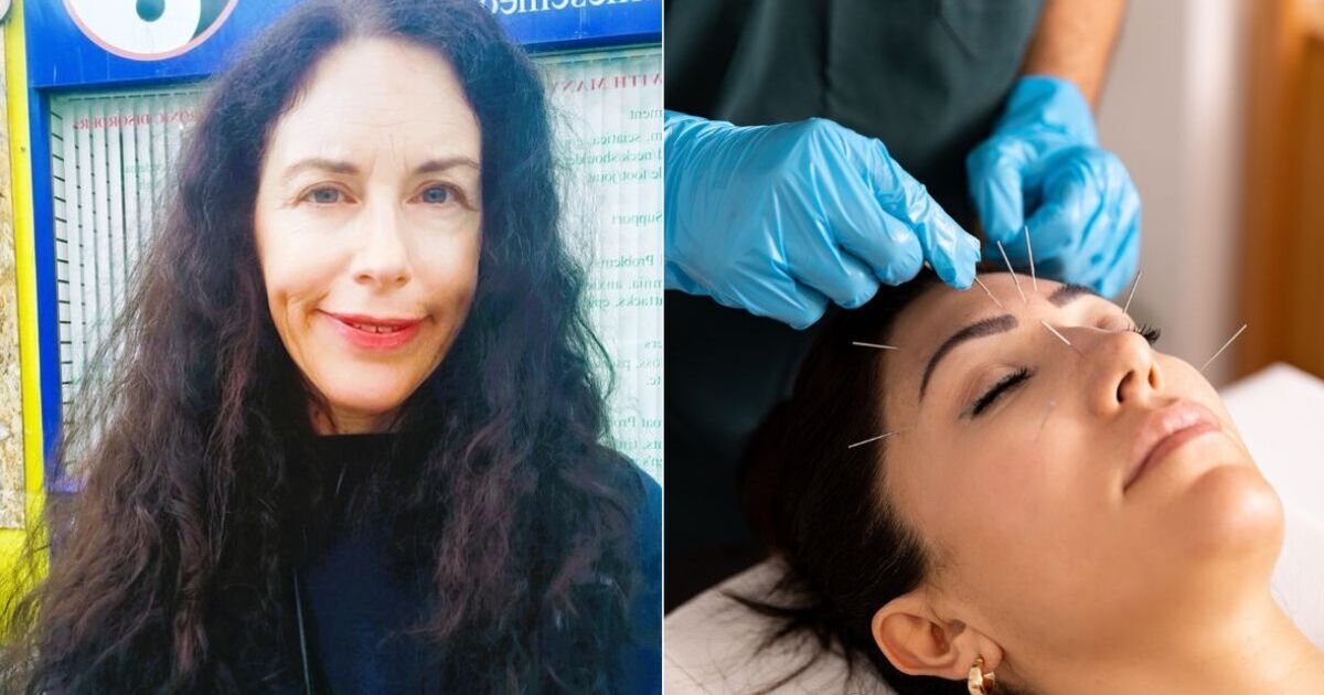 Experimentei a acupuntura e tive uma experiência inesperada - foi surpreendente