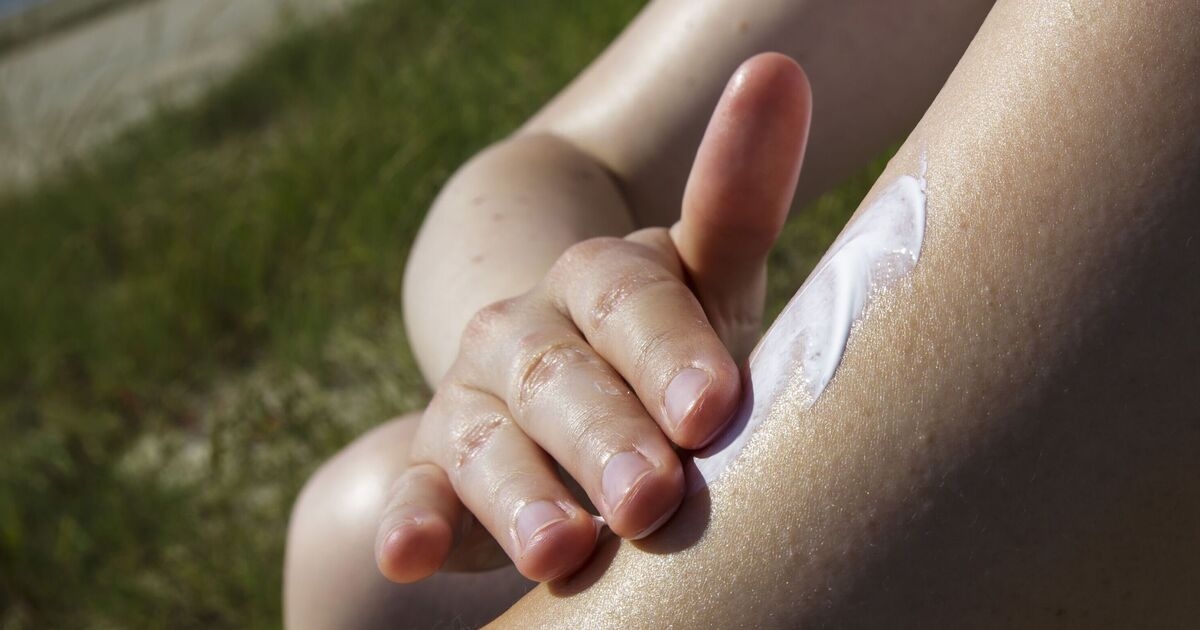 Red flag skin cancer symptoms to look for after 15 minutes in the sun