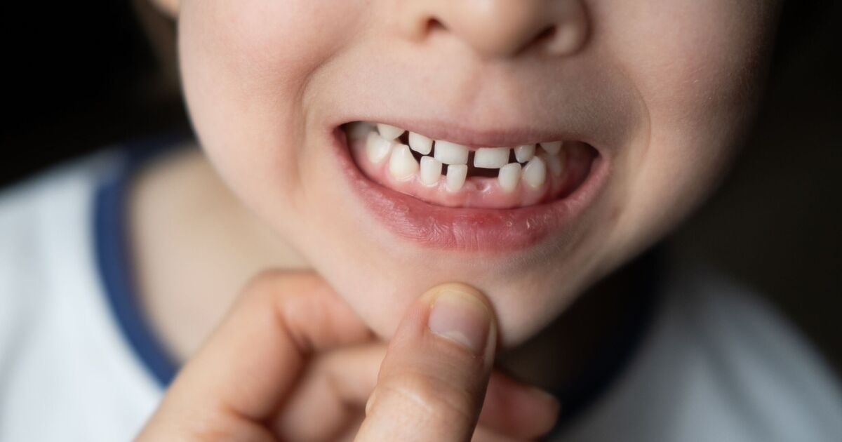 Jestem dentystą – nigdy nie ignoruj tych objawów u dzieci