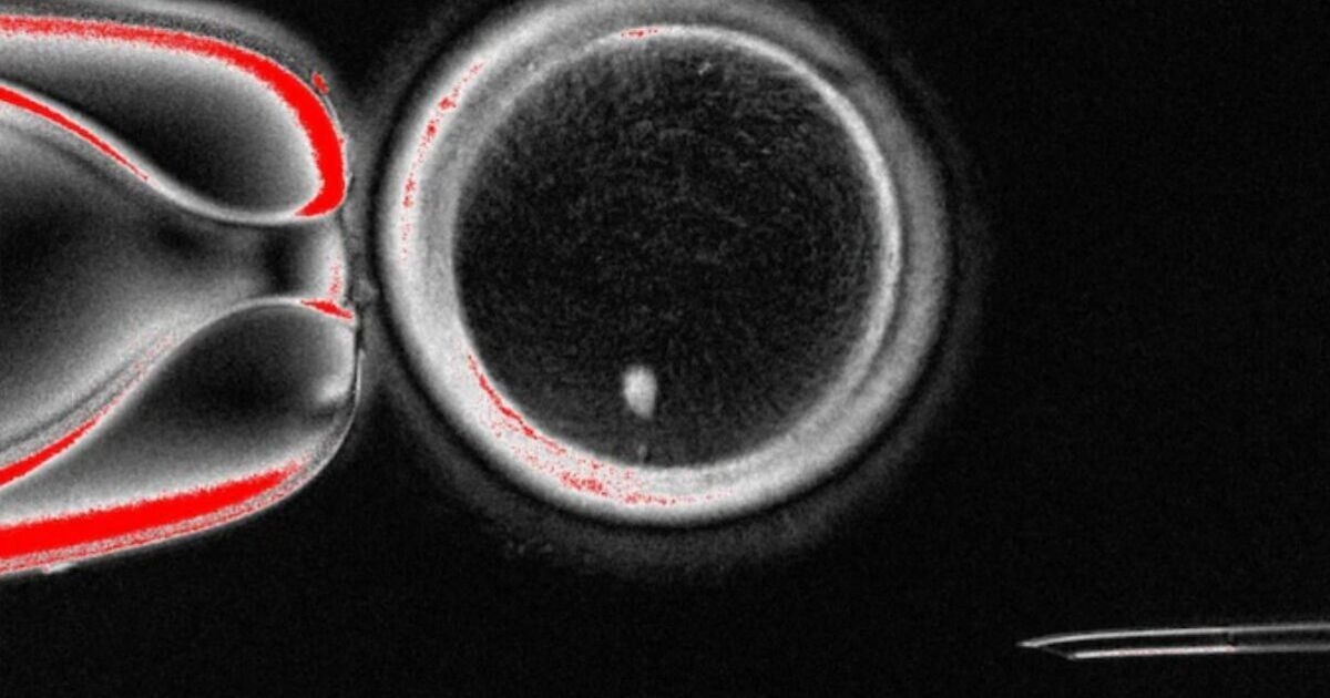 Gli scienziati fanno una grande scoperta: i bambini potrebbero nascere senza madri biologiche
