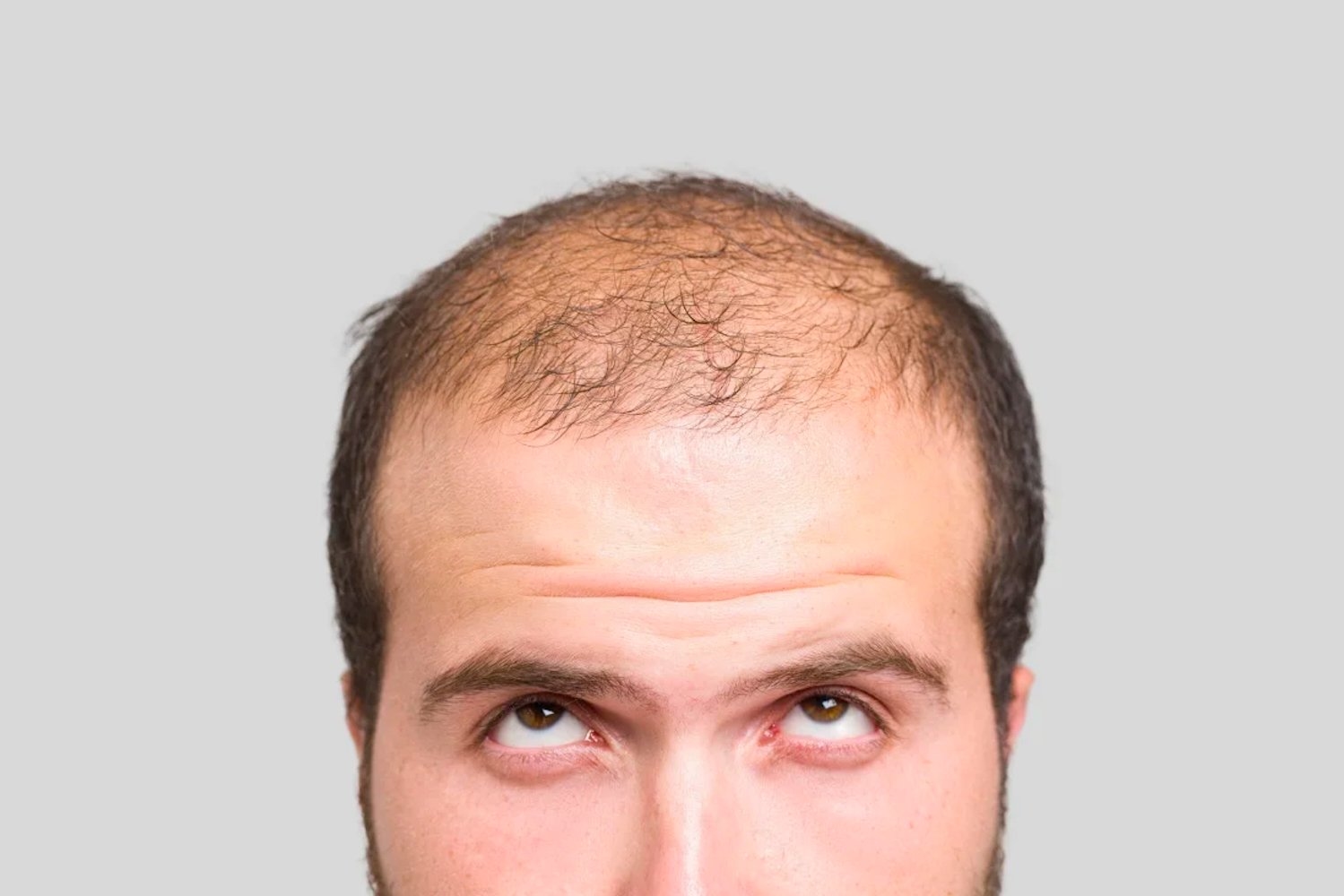 Cientistas da UCLA desenvolvem creme tópico que faz o cabelo crescer novamente em apenas uma semana
