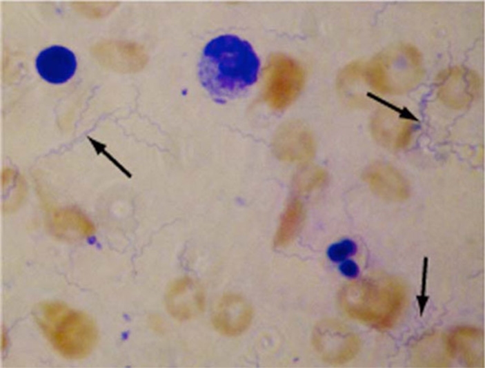 L'emergere dell'epidemia di tipo recidivante fu facilitato dalla diffusione degli indumenti di lana