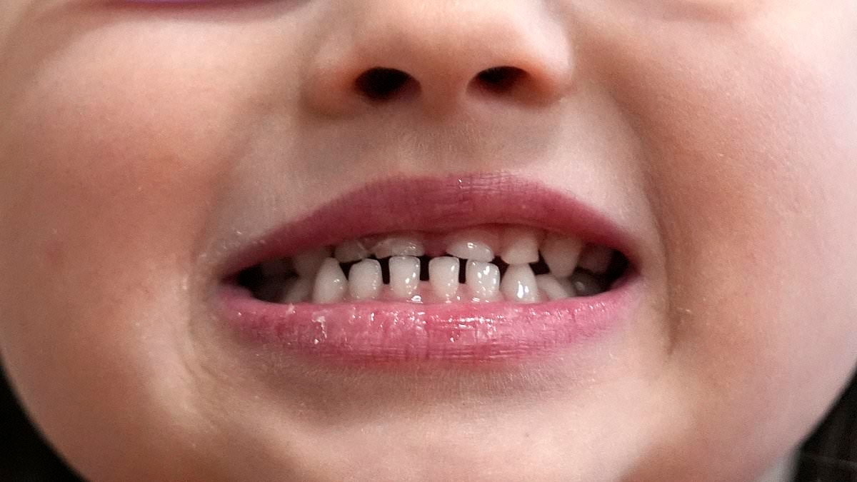 La FDA s'apprête à interdire des compléments alimentaires populaires par crainte qu'ils ne provoquent des lésions cérébrales