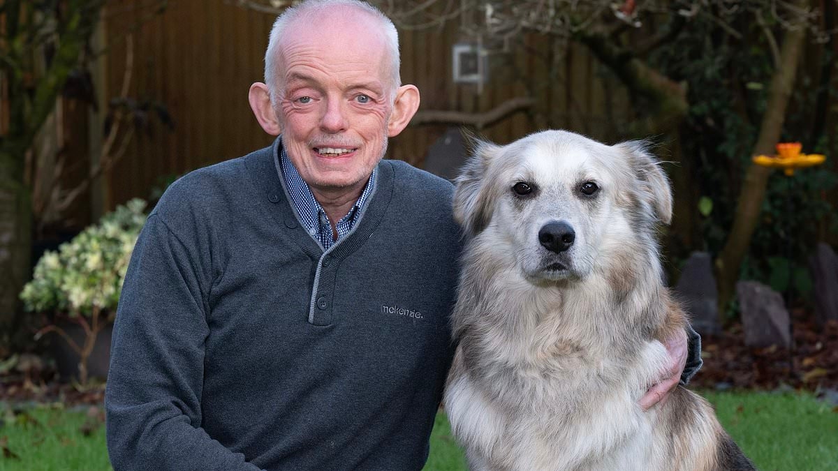 Un piccolo nodulo nella bocca di Steve si è rivelato essere un tumore tonsillare mortale. Mentre i casi di cancro alla testa e al collo aumentano del 20%, i medici ne individuano la causa sorprendente e spiegano come proteggersi.