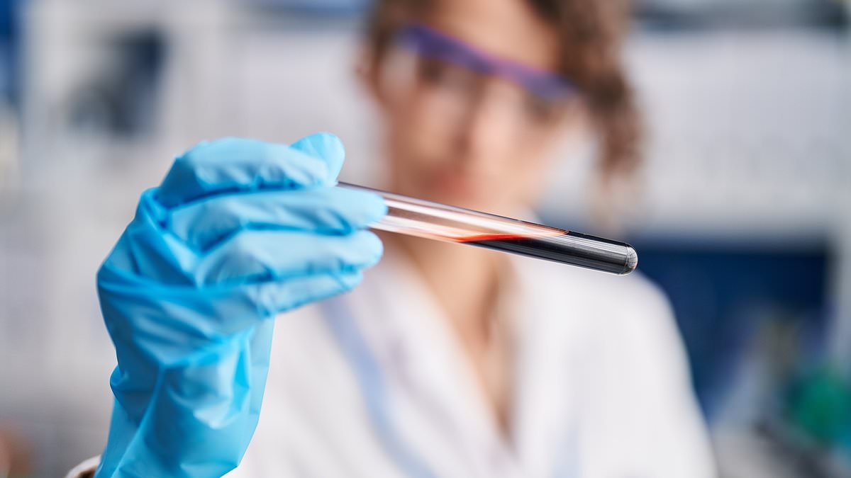 Eenvoudige bloedtest waarmee kan worden vastgesteld of u snel ernstige Alzheimer zult ontwikkelen