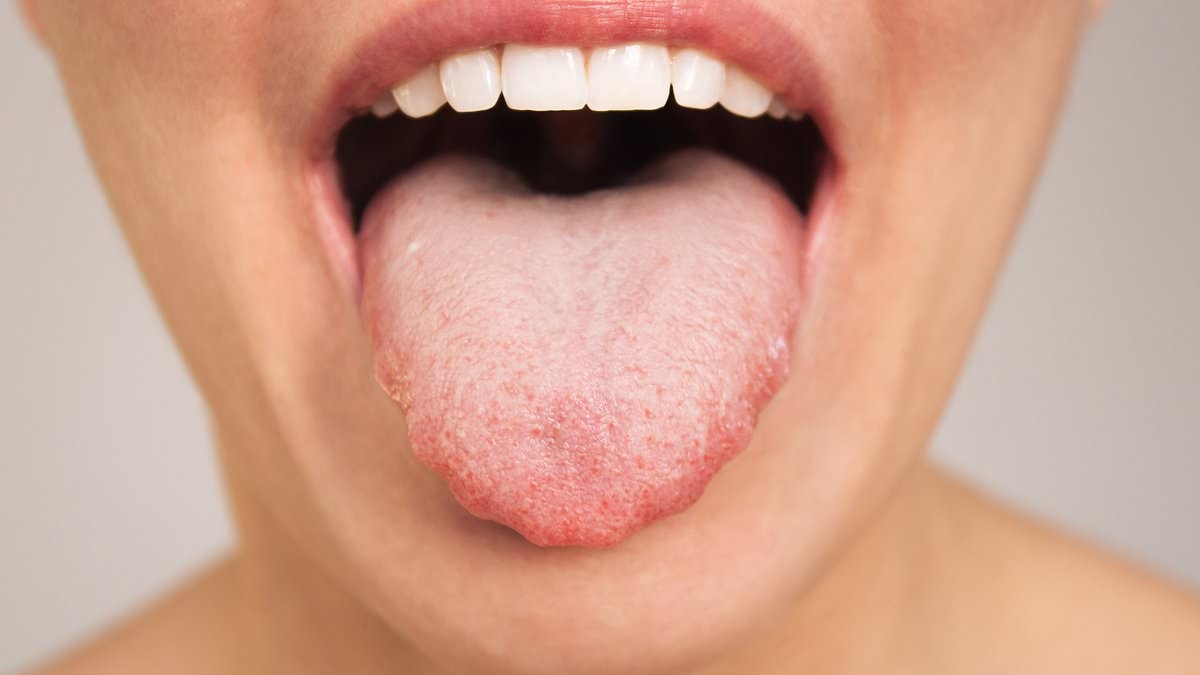 Why does my tongue keep tingling? It could be harmless. But it could also be lethal. Doctors reveal the subtle symptom differences