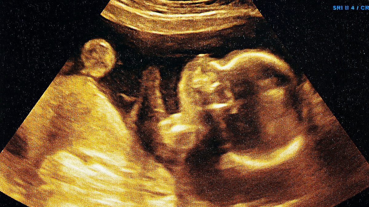 Using AI to analyse ultrasound scans lets parents pinpoint exact due date of babies, study claims