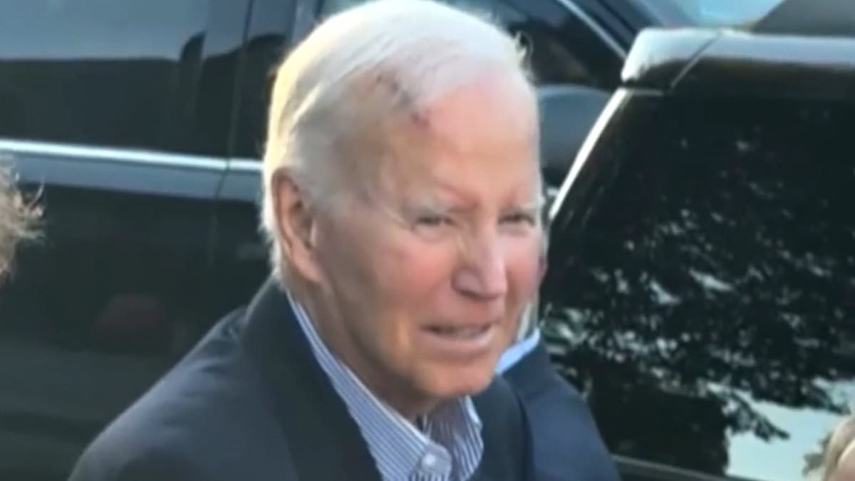 O que é a cirurgia de Mohs? A técnica precisa usada para remover o câncer de pele de Joe Biden