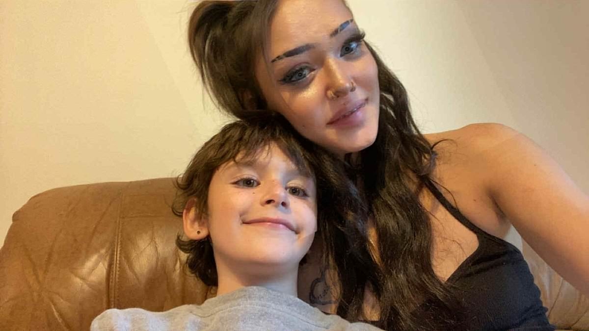 Mom 'comes back from the dead' after scooter accident leaves 'brain hanging out her head'
