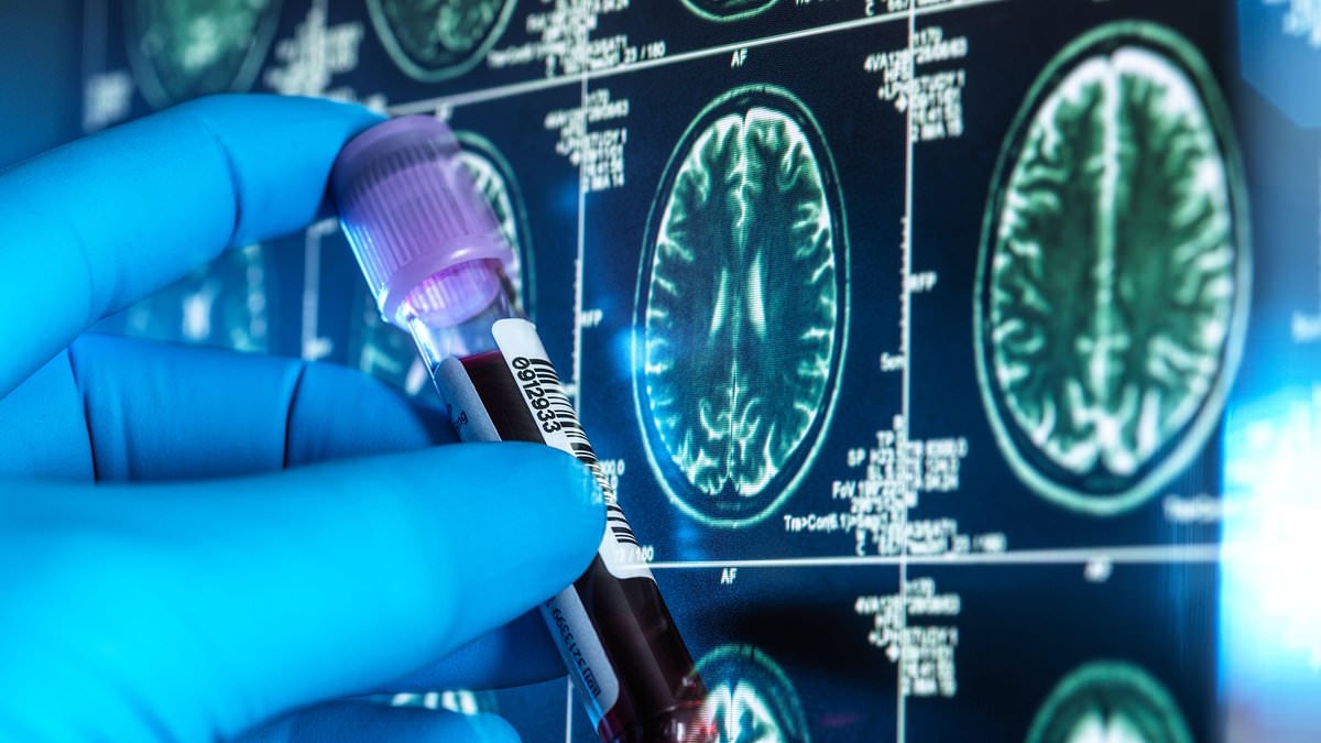 O que é a doença de Huntington? A doença devastadora e sem cura é tratada pela primeira vez com terapia genética inovadora.
