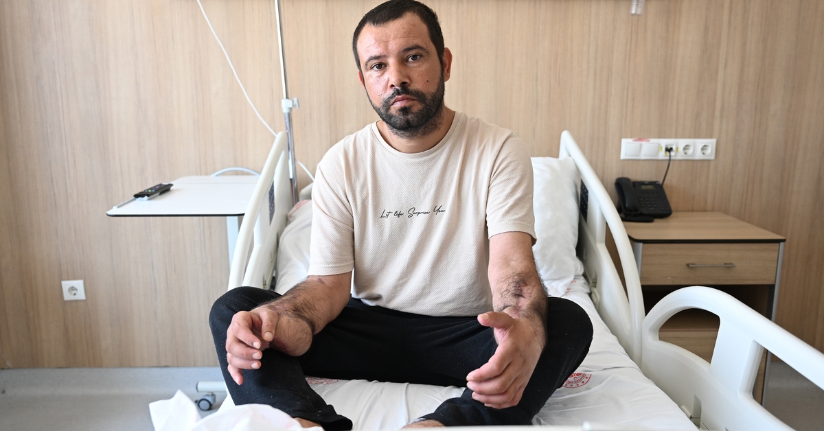 Uzuvlarını kaybedecekti! Doku nakliyle 5 ay sonra ayağa kalktı