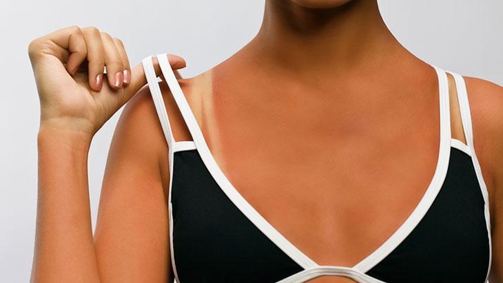 Yazın bronz tenli olmak çok moda! ‘Sağlıklı bronzlaşma diye bir şey yok’