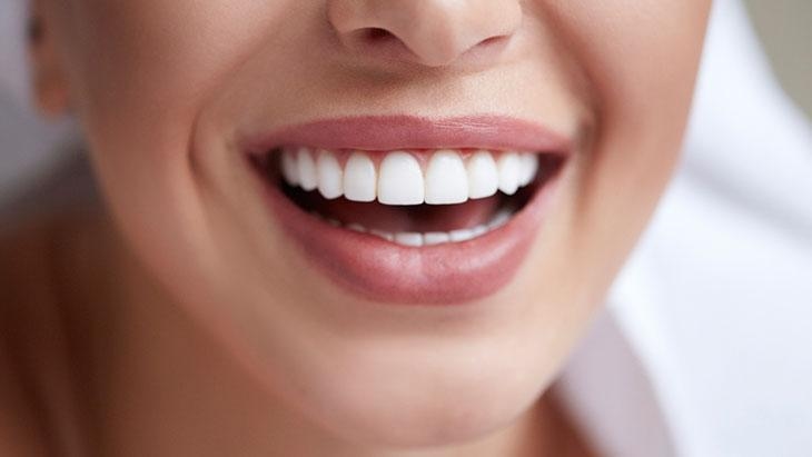 ¡Es muy popular últimamente! ¿Es perjudicial blanquearse los dientes?
