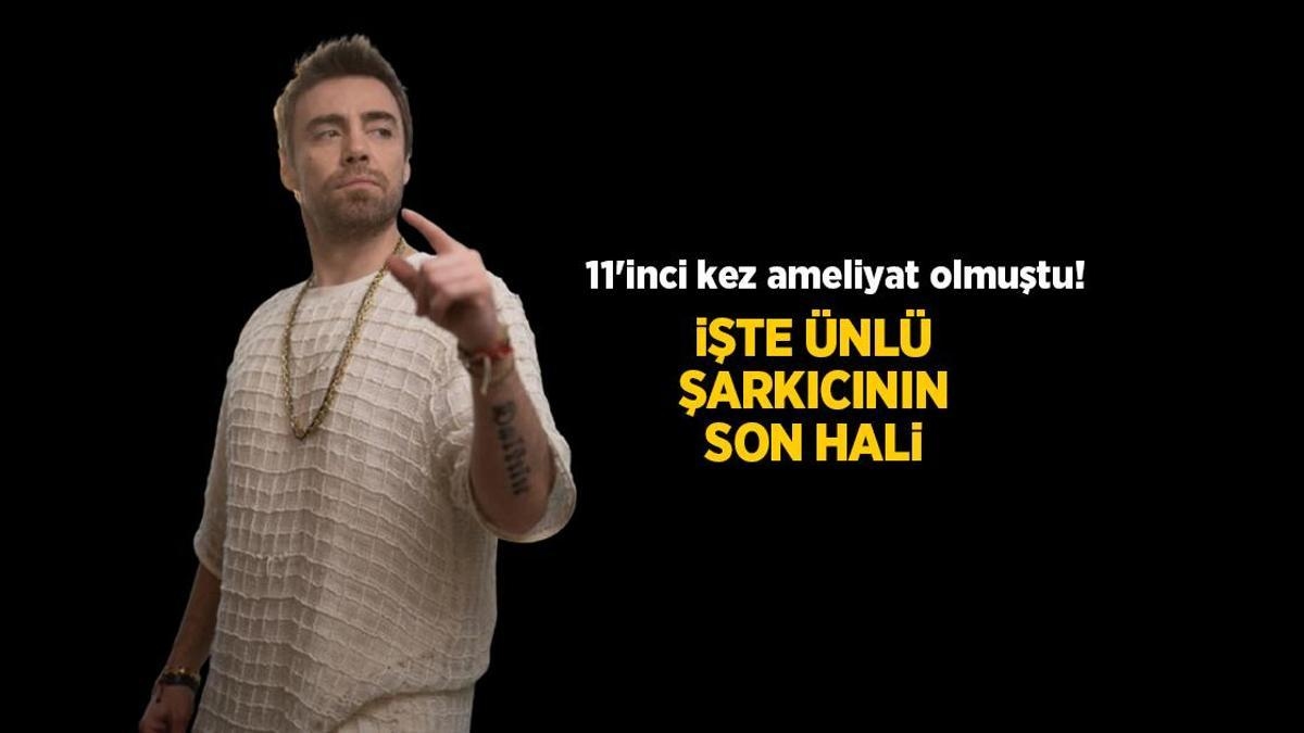 NIEUWS: Murat Dalkılıç heeft voor de 11e keer een neusoperatie ondergaan! Bekijk de definitieve versie