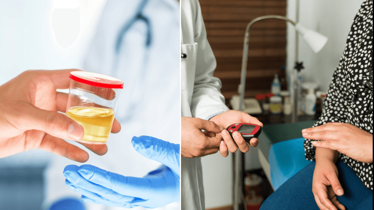What gives urine its yellow color? The answer lies in the intestine.