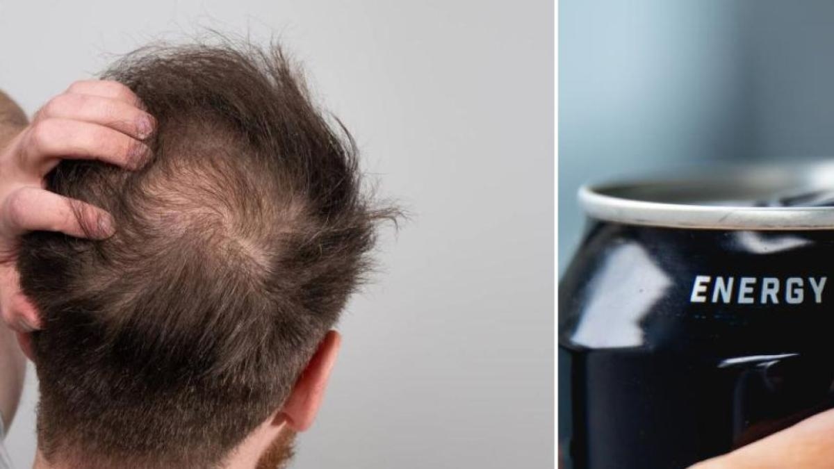 Studies show that drinking soda contributes to hair loss