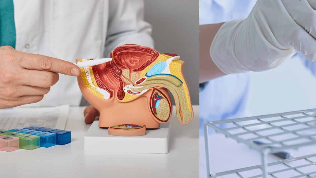 A urine test could reveal early-stage prostate cancer: How does it work?