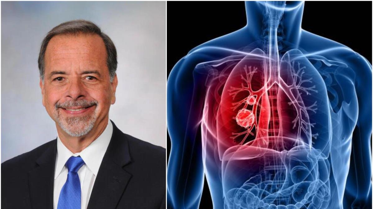 Aumentan casos de cáncer de pulmón en personas que nunca han fumado y aún no se sabe por qué, advierte neumólogo