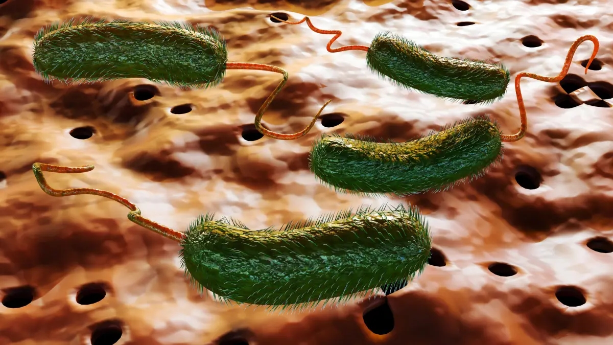 Why is the bacteria that has caused deaths in the United States called "flesh-eating"? This is what you should know about the infection and its alarming symptoms.