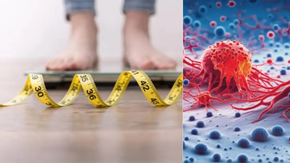 Abnehmen kann laut wissenschaftlichen Studien bis zu 13 Krebsarten vorbeugen: Experten erklären, welche Auswirkungen es auf die Gesundheit hat.