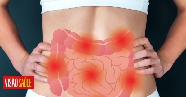 7 Answers About Irritable Bowel Syndrome