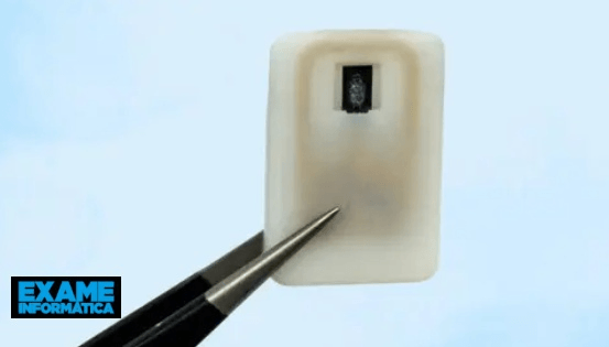 Un nuovo impianto del MIT previene l'ipoglicemia fatale nei diabetici