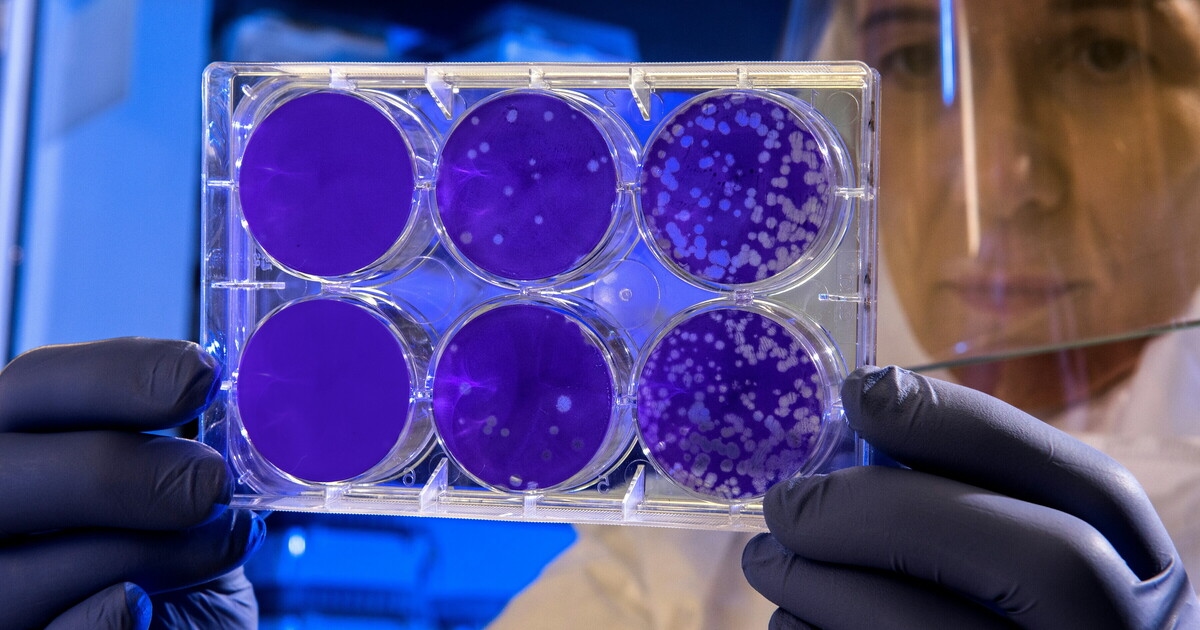 Il sistema immunitario si nutre del nemico: i macrofagi trasformano i patogeni in nutrienti
