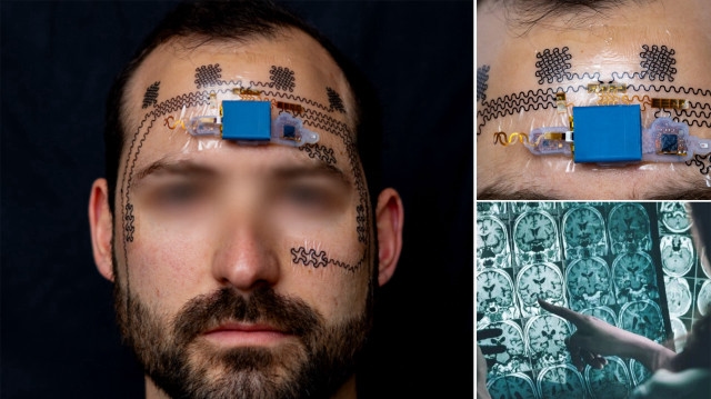 Elektronisches Tattoo gegen Arbeitsstress: Es schlägt Alarm, wenn Sie zu viel arbeiten