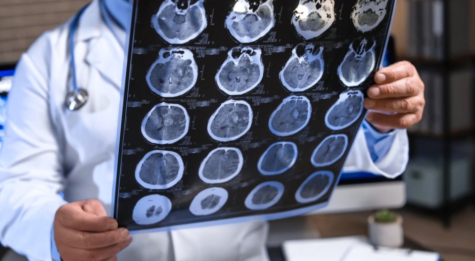 Una birra al giorno: uno studio approfondito dimostra come influisce davvero sul cervello