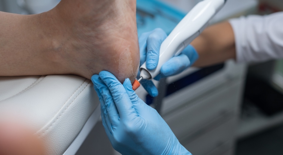 Nowe czynności zawodowe podiatry. Obowiązują od 14 czerwca