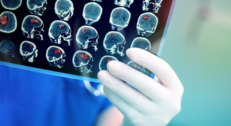 Schlüssel zum Gehirn, schützt vor Gedächtnisverlust. Das haben Wissenschaftler herausgefunden