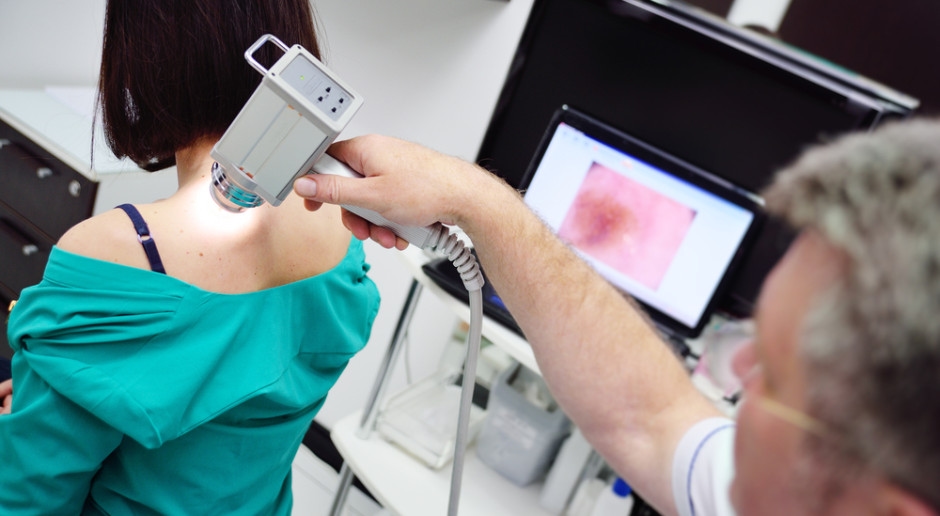 Vale a pena verificar suas pintas no verão. Um dermatologista explica como a dermatoscopia funciona e por que ela é importante.