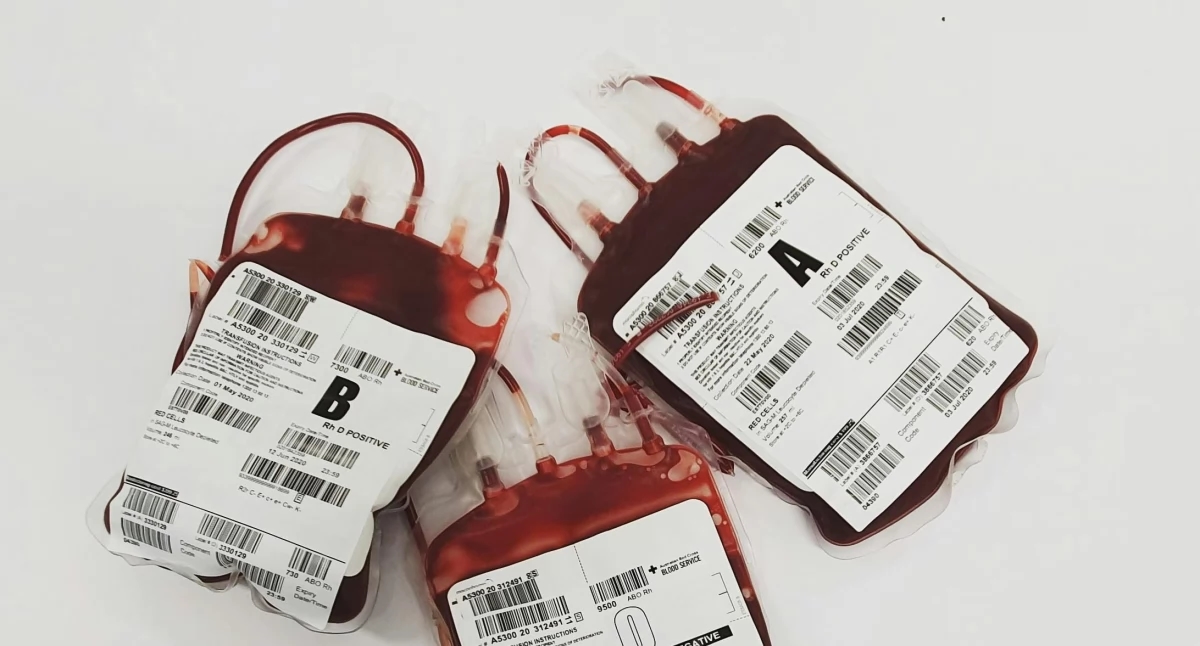 Anemia - symptoms and treatment of anemia