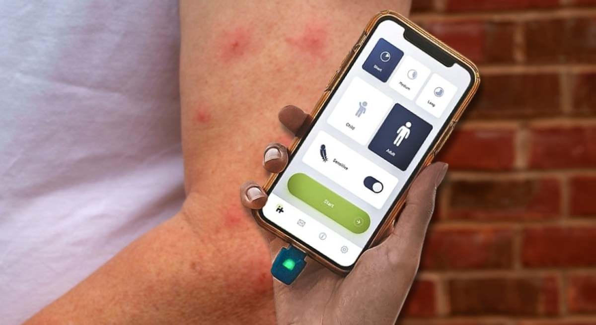 Diga adeus à coceira causada por picadas de mosquito: a invenção que acaba com a coceira do seu celular