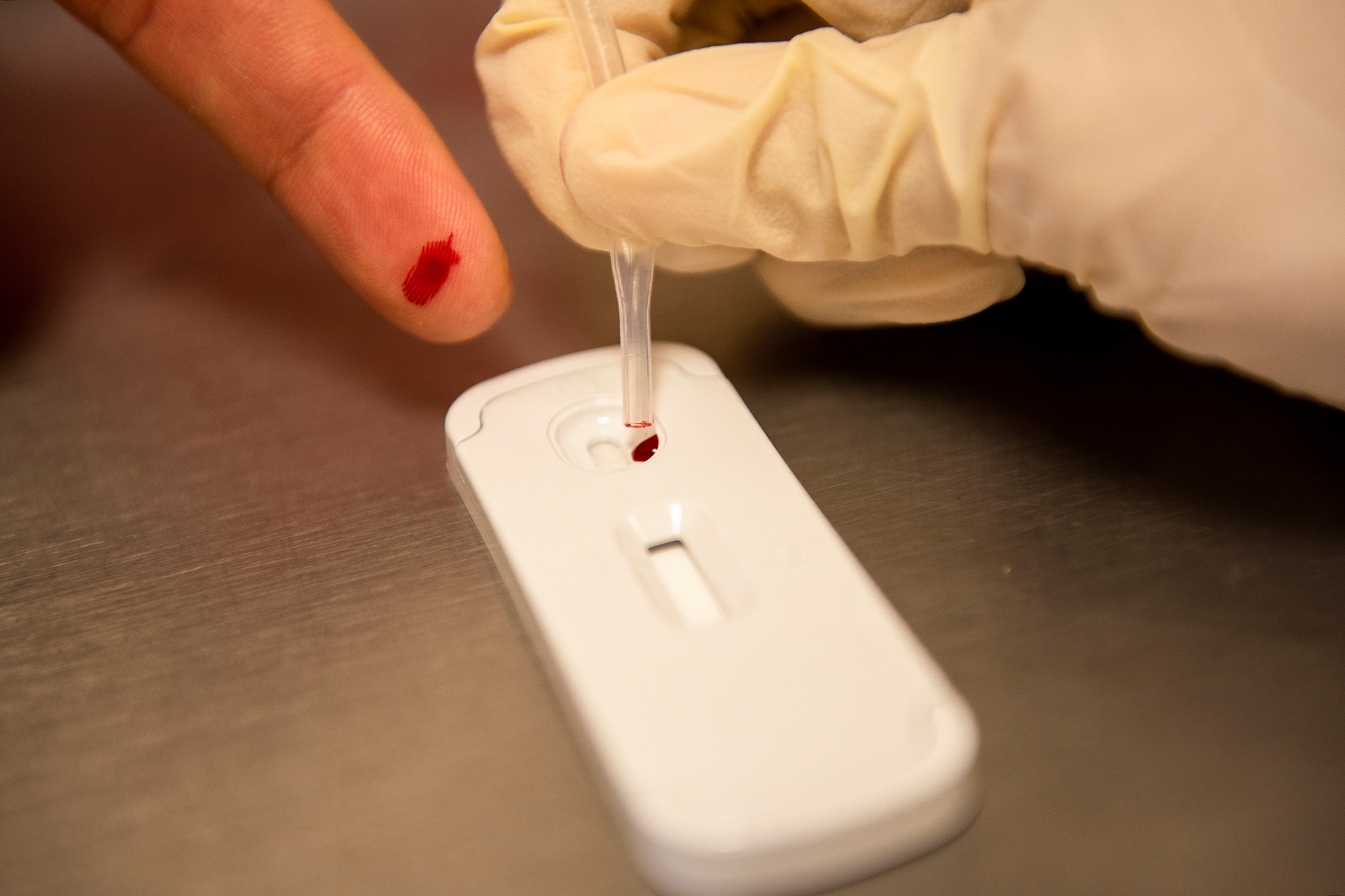 Capasits, Torreón'da 32 yeni HIV vakası ve iki ölüm bildirdi.