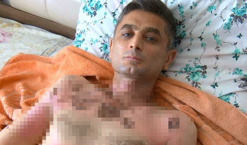Telefonunu gasp ettikten sonra kendisinden şikayetçi oldu diye benzin döküp yaktı