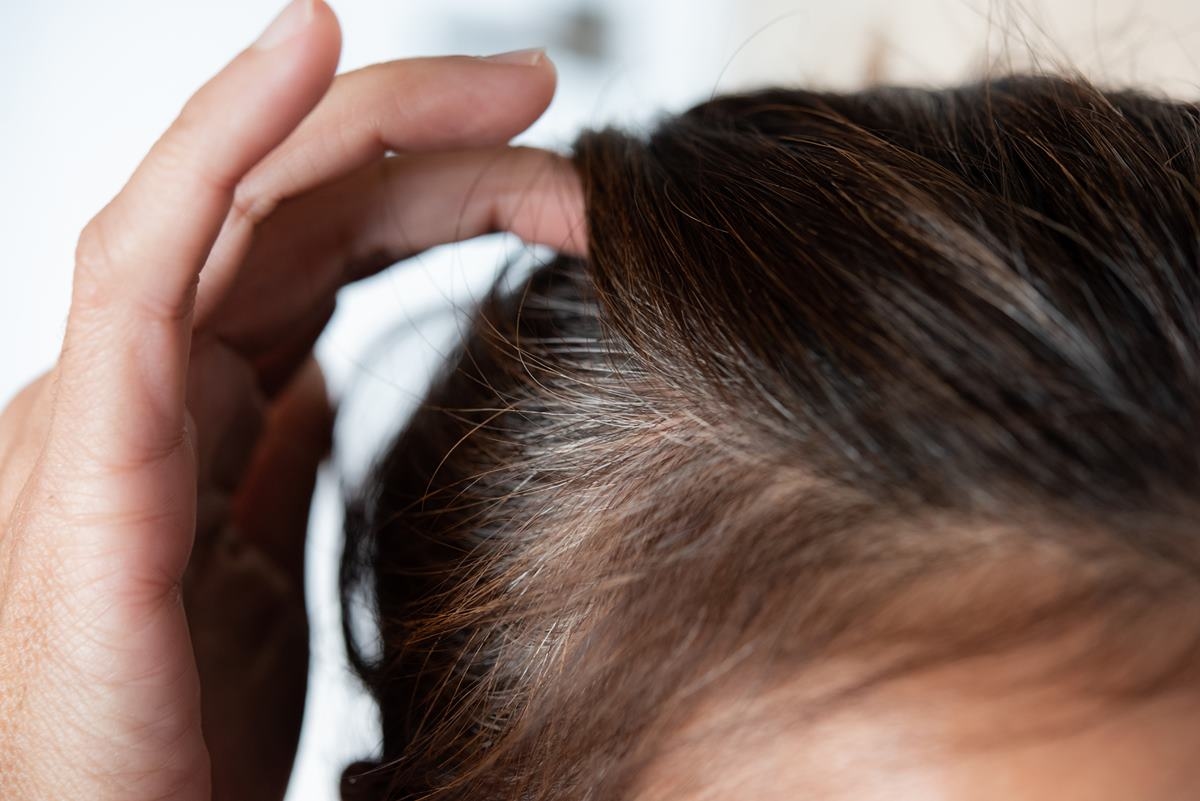 Geen grijs haar meer: ​​natuurlijk recept dekt haar in minuten