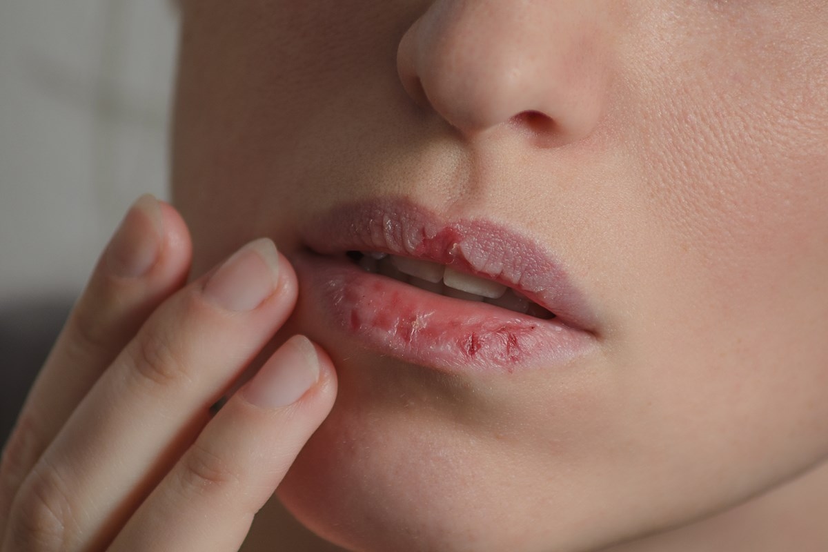 Protege tus labios del frío: 4 humectantes buenos y baratos por hasta R$ 30