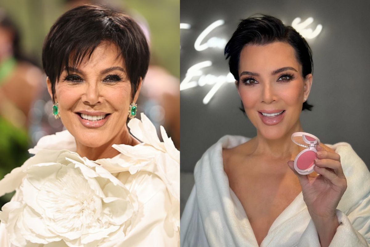Kris Jenner: Dokter onthult trucs die haar ‘20 jaar jonger’ maakten