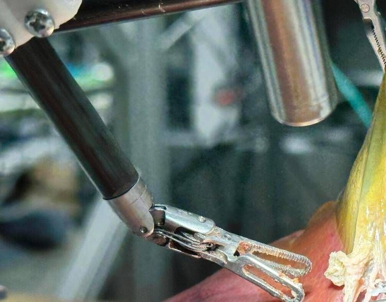 The 'robot doctor' operates alone, the first surgery without human assistance.