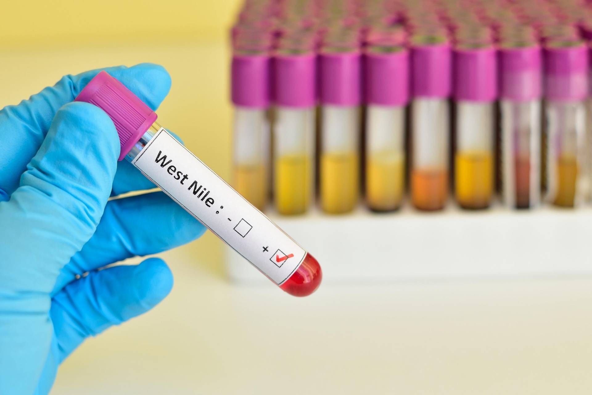 West-Nil-Virus, ISS: „10 Fälle seit Jahresbeginn, 7 in der Provinz Latina.“