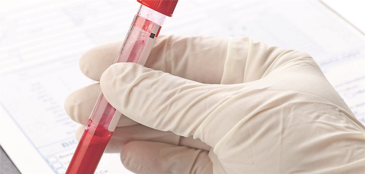 New lipid-lowering drug obicetrapib reduces LDL cholesterol and lipoprotein(a)