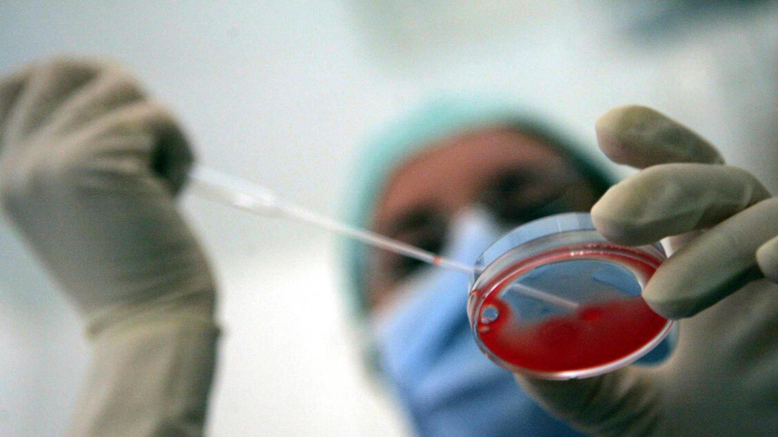 Autismus und Schizophrenie: Es wird an einer Behandlung zu ihrer Vorbeugung geforscht.