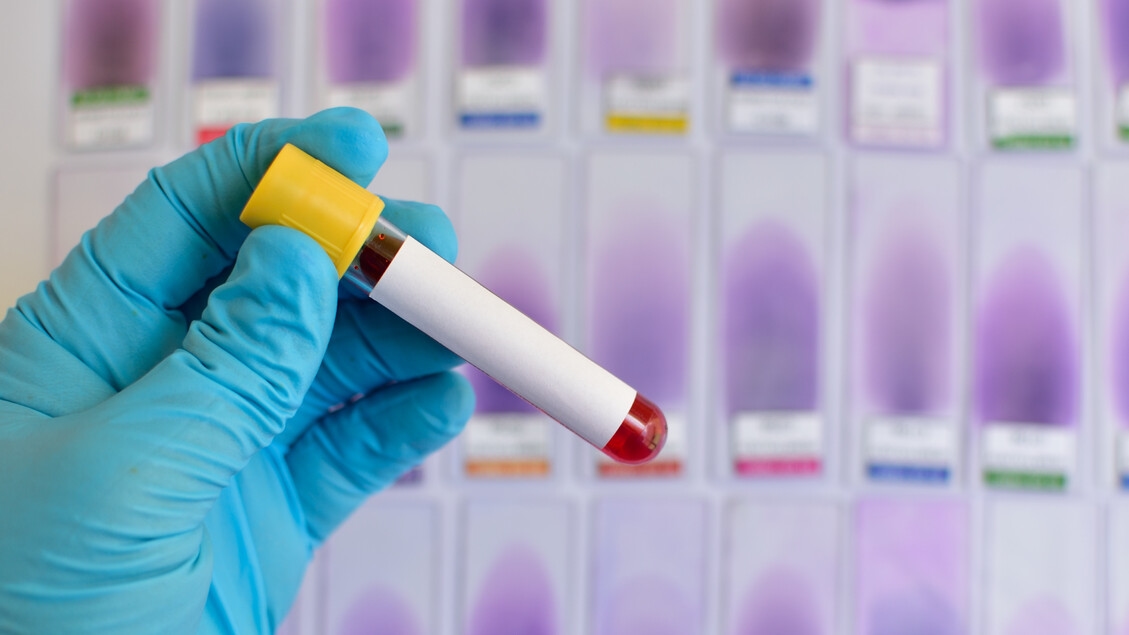 ISS kündigt einen nationalen Plan gegen Hepatitis und HIV an