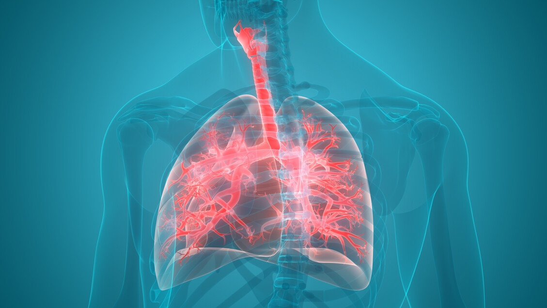 Tumore al polmone, nel 70% dei casi la diagnosi arriva tardi