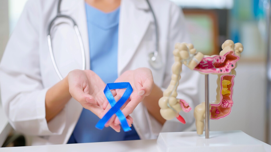 Novel Strategy Makes Colorectal Cancers Sensitive to Immunotherapy