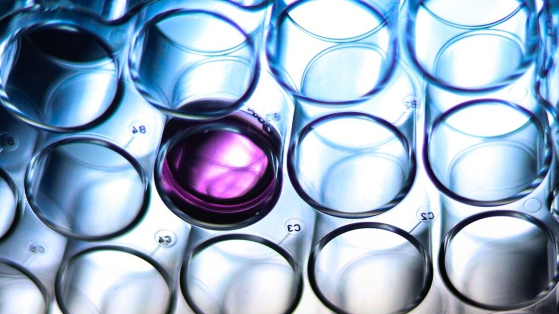 Nuove molecole anticancro uccidono le cellule malate più forti