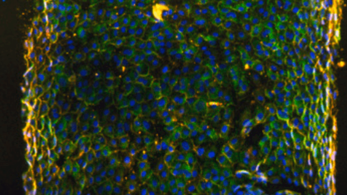 Pronto il bioreattore che riproduce i tumori in laboratorio
