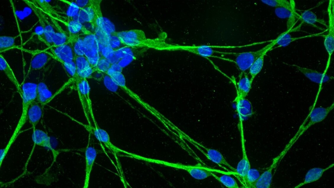 Organoides impressos em 3D para a medicina personalizada do futuro