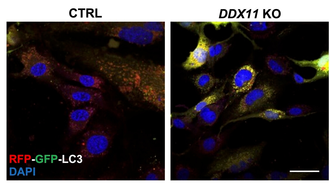 Una proteina dal doppio lavoro contro la neurodegenerazione